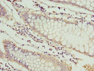 Mt1G Polyclonal Antibody - image 2