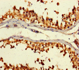 Immunofluorescence staining of PC-3 cells with CAC09234 at 1:133, counter-stained with DAPI. The cells were fixed in 4% formaldehyde, permeabilized using 0.2% Triton X-100 and blocked in 10% normal Goat Serum. The cells were then incubated with the antibody overnight at 4°C. The secondary antibody was Alexa Fluor 488-congugated AffiniPure Goat Anti-Rabbit IgG(H+L).