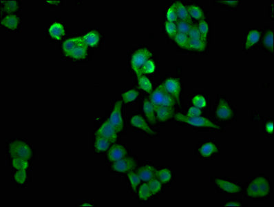 Immunofluorescence staining of HepG2 cells with CAC09234 at 1:66, counter-stained with DAPI. The cells were fixed in 4% formaldehyde, permeabilized using 0.2% Triton X-100 and blocked in 10% normal Goat Serum. The cells were then incubated with the antibody overnight at 4°C. The secondary antibody was Alexa Fluor 488-congugated AffiniPure Goat Anti-Rabbit IgG(H+L).