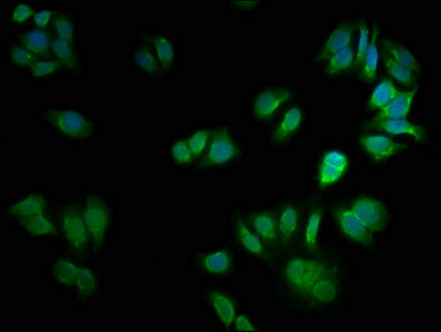 Csnk2A2 Polyclonal Antibody - image 4