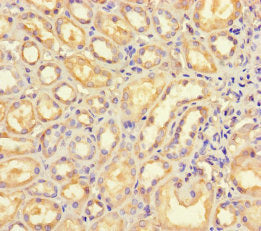 Immunohistochemistry of paraffin-embedded human liver tissue using CAC09235 at dilution of 1:100