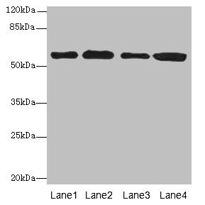 Immunohistochemistry of paraffin-embedded human liver tissue using CAC09255 at dilution of 1:100