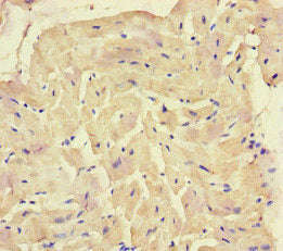 Immunohistochemistry of paraffin-embedded human placenta tissue using CAC09268 at dilution of 1:100