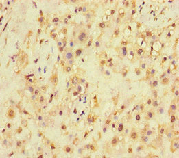 Immunofluorescent analysis of MCF-7 cells using CAC09268 at dilution of 1:100 and Alexa Fluor 488-congugated AffiniPure Goat Anti-Rabbit IgG(H+L)
