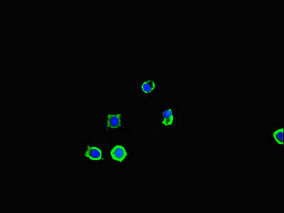 Immunoprecipitating SQSTM1 in Hela whole cell lysate ; , Lane 1: Rabbit control IgG (1µg) instead in Hela whole cell lysate., For western blotting, a HRP-conjugated Protein G antibody was used as the secondary antibody (1/2000); , Lane 2: CAC09268 (6µg) + Hela whole cell lysate (500µg); , Lane 3: Hela whole cell lysate (10µg);