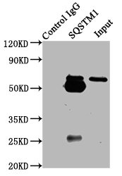 Sqstm1 Polyclonal Antibody - image 5