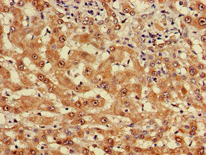 Immunohistochemistry of paraffin-embedded human adrenal gland tissue using CAC09296 at dilution of 1:100