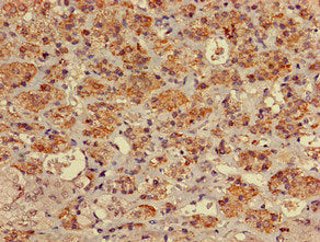 Immunofluorescent analysis of HepG2 cells using CAC09296 at dilution of 1:100 and Alexa Fluor 488-congugated AffiniPure Goat Anti-Rabbit IgG(H+L)
