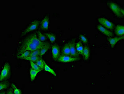 Myo7A Polyclonal Antibody - image 4