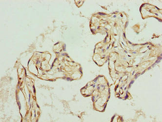 Western blot; , All lanes: TRIP13 antibody at 1µg/ml + A549 whole cell lysate; , Secondary; , Goat polyclonal to rabbit IgG at 1/10000 dilution; , Predicted band size: 49, 23 kDa; , Observed band size: 49 kDa