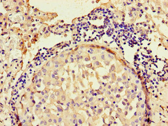 Immunohistochemistry of paraffin-embedded human adrenal gland tissue using CAC09324 at dilution of 1:100