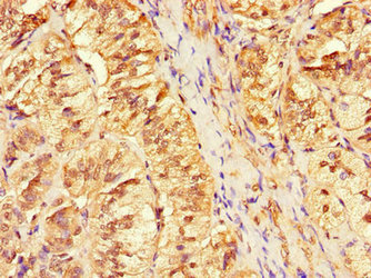 Immunofluorescent analysis of Hela cells using CAC09324 at dilution of 1:100 and Alexa Fluor 488-congugated AffiniPure Goat Anti-Rabbit IgG(H+L)