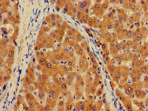 Immunohistochemistry of paraffin-embedded human brain tissue using CAC09327 at dilution of 1:100
