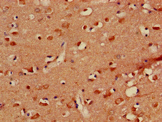 Immunofluorescent analysis of A549 cells using CAC09327 at dilution of 1:100 and Alexa Fluor 488-congugated AffiniPure Goat Anti-Rabbit IgG(H+L)