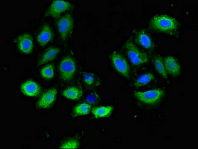 Plxnd1 Polyclonal Antibody - image 4