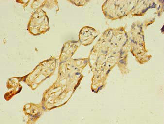 Immunofluorescent analysis of HepG2 cells using CAC09348 at dilution of 1:100 and Alexa Fluor 488-congugated AffiniPure Goat Anti-Rabbit IgG(H+L)