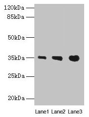 Immunofluorescent analysis of Hela cells using CAC09363 at dilution of 1:100 and Alexa Fluor 488-congugated AffiniPure Goat Anti-Rabbit IgG(H+L)