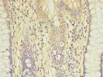 Agbl2 Polyclonal Antibody - image 3