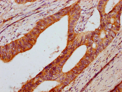 IHC image diluted at 1:400 and staining in paraffin-embedded human skeletal muscle tissue performed on a Leica BondTM system. After dewaxing and hydration, antigen retrieval was mediated by high pressure in a citrate buffer (pH 6.0). Section was blocked with 10% normal goat serum 30min at RT. Then primary antibody (1% BSA) was incubated at 4°C overnight. The primary is detected by a biotinylated secondary antibody and visualized using an HRP conjugated SP system.