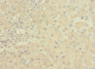 Immunohistochemistry of paraffin-embedded human kidney tissue using CAC09389 at dilution of 1:100