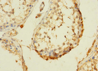Immunohistochemistry of paraffin-embedded human kidney tissue using CAC09399 at dilution of 1:100