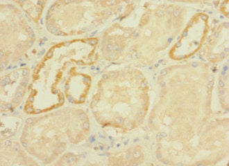 Dhx32 Polyclonal Antibody - image 4