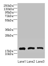 Immunohistochemistry of paraffin-embedded human brain tissue using CAC09407 at dilution of 1:100