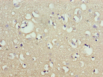 Immunofluorescent analysis of A549 cells using CAC09407 at dilution of 1:100 and Alexa Fluor 488-congugated AffiniPure Goat Anti-Rabbit IgG(H+L)