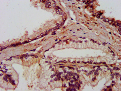 IHC image diluted at 1:800 and staining in paraffin-embedded human prostate tissue performed on a Leica BondTM system. After dewaxing and hydration, antigen retrieval was mediated by high pressure in a citrate buffer (pH 6.0). Section was blocked with 10% normal goat serum 30min at RT. Then primary antibody (1% BSA) was incubated at 4°C overnight. The primary is detected by a biotinylated secondary antibody and visualized using an HRP conjugated SP system.
