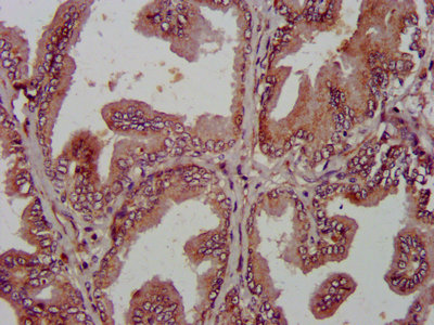 Immunofluorescence staining of A549 cells with CAC09433 at 1:266, counter-stained with DAPI. The cells were fixed in 4% formaldehyde, permeabilized using 0.2% Triton X-100 and blocked in 10% normal Goat Serum. The cells were then incubated with the antibody overnight at 4°C. The secondary antibody was Alexa Fluor 488-congugated AffiniPure Goat Anti-Rabbit IgG(H+L).