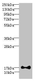 Immunohistochemistry of paraffin-embedded human prostate cancer using CAC09434 at dilution of 1:100