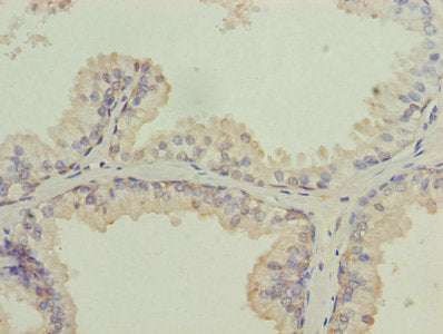 Immunohistochemistry of paraffin-embedded human tonsil tissue using CAC09434 at dilution of 1:100