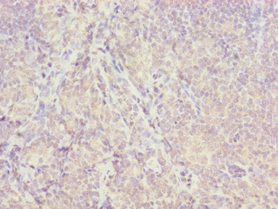 Isca2 Polyclonal Antibody - image 4
