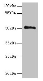 Immunohistochemistry of paraffin-embedded human colon cancer using CAC09439 at dilution of 1:100