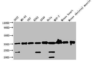 Immunohistochemistry of paraffin-embedded human lung cancer using CAC09448 at dilution of 1:100