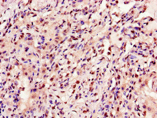Ankrd23 Polyclonal Antibody - image 3