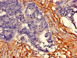 Immunofluorescent analysis of HepG2 cells using CAC09452 at dilution of 1:100 and Alexa Fluor 488-congugated AffiniPure Goat Anti-Rabbit IgG(H+L)