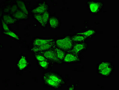 Western Blot; , Positive WB detected in: Rat heart tissue, Mouse stomach tissue; , All lanes: TPH2 antibody at 3µg/ml; , Secondary; , Goat polyclonal to rabbit IgG at 1/50000 dilution; , Predicted band size: 57 kDa; , Observed band size: 57 kDa