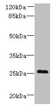 Immunohistochemistry of paraffin-embedded human colon cancer using CAC09454 at dilution of 1:100
