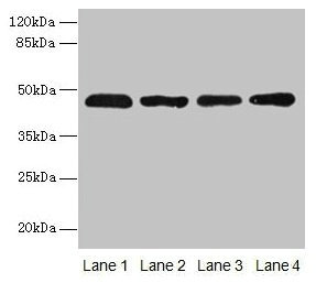 Immunohistochemistry of paraffin-embedded human colon cancer using CAC09477 at dilution of 1:100