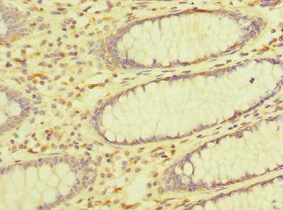Immunofluorescent analysis of 293T cells using CAC09477 at dilution of 1:100 and Alexa Fluor 488-congugated AffiniPure Goat Anti-Rabbit IgG(H+L)