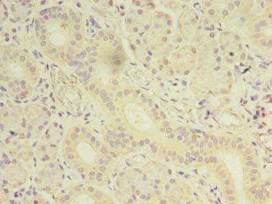 Immunohistochemistry of paraffin-embedded human skin tissue using CAC09503 at dilution of 1:100