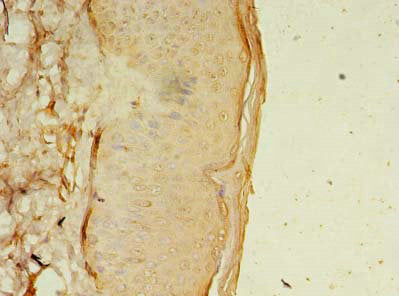 Osr2 Polyclonal Antibody - image 4