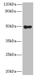 Immunohistochemistry of paraffin-embedded human colon cancer using CAC09516 at dilution of 1:100
