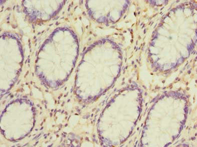Gsdmb Polyclonal Antibody - image 3