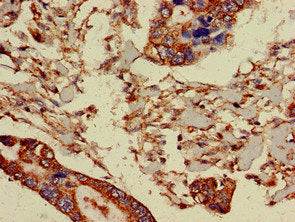 Immunofluorescent analysis of PC-3 cells using CAC09531 at dilution of 1:100 and Alexa Fluor 488-congugated AffiniPure Goat Anti-Rabbit IgG(H+L)