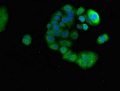 Western Blot; , Positive WB detected in: Mouse heart tissue; , All lanes: PRR11 antibody at 3.2µg/ml; , Secondary; , Goat polyclonal to rabbit IgG at 1/50000 dilution; , Predicted band size: 41 kDa; , Observed band size: 41 kDa