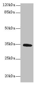 Setd9 Polyclonal Antibody - image 2