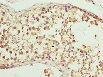 Cfap52 Polyclonal Antibody - image 3
