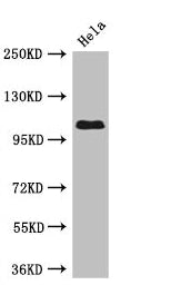 Immunohistochemistry of paraffin-embedded human prostate cancer using CAC09557 at dilution of 1:100